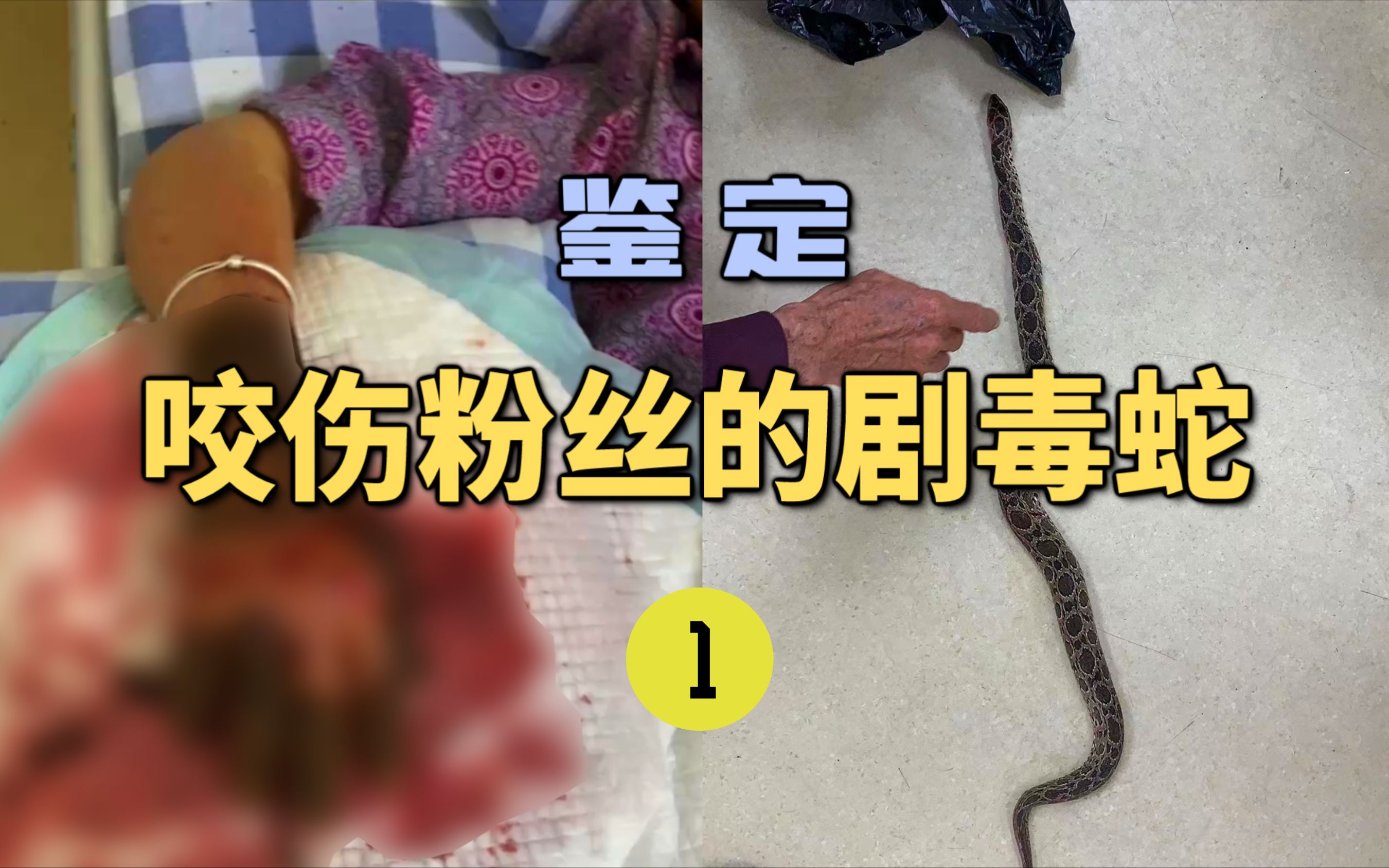鉴定咬伤粉丝的毒蛇(1)亲戚被泰国圆斑蝰咬伤！医院没有抗毒血清？