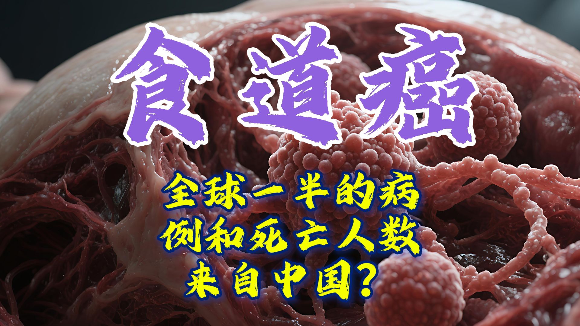 中国食道癌占全世界一半？趁热吃趁热喝害了多少人【癌症01】